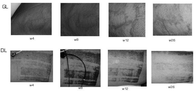 Fig. 1Illustrative view (digital photo) of the graft lesion area (GL in the right lateral dorsum) and donor lesion area (DL in the anterointernal face of the left thigh) evolution during the study time course (vol. #9).