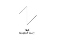 Fig. 2Single Z-plasty