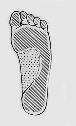 Fig. 1Weight- and nonweight-bearing areas.