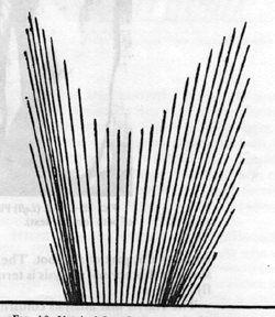 Fig. 2Vertical foot-floor reaction vector of a normal subject walking at free walking speed. From Simon D.T.: Foot-floor calculated reaction vector. Bull. Prosthet. Res., 18: 309, 1981.