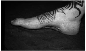 Fig. 9Good result after 10 months.