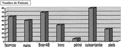 Fig. 4R�partition selon la localisation.