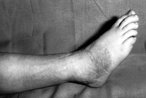 Fig. 6Operative results one year later.