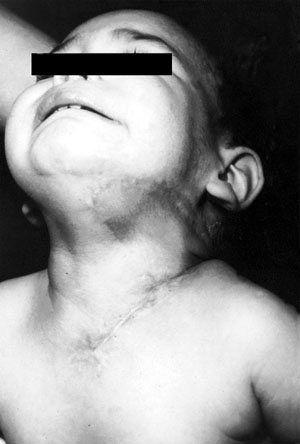 Fig. 9Operative result seven months later.