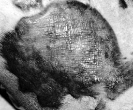 Fig. 1Split-skin donor site without razor-thick skin coverage.