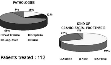 Table IPatients undergoing osseointegration in the two operating units respectively in Palermo and in Rome
