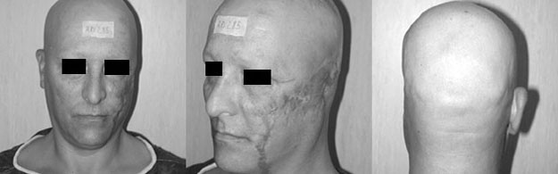 Fig. 9The patient on admission.