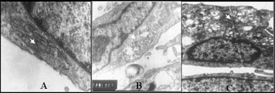 Fig. 5Electron microscopy analysis of dermal fibroblasts isolated from keloid (A), normal skin (B), and hypertrophic scar (C). Arrows indicate endoplasmic reticulum.