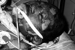 Fig. 2Some of the patients.