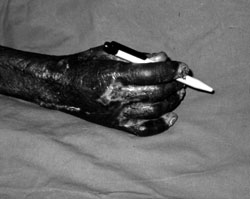 Fig. 4Some of the patients.