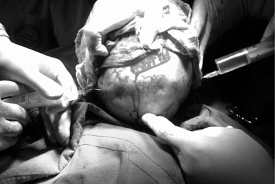 Fig. 2Scalp of child.