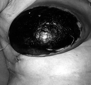 Fig. 6Automatic skin disease.