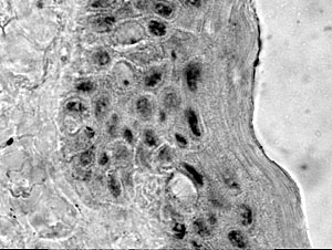 Fig. 6Our data showed that cells expressing nuclear p63 were detected in one row of basal cells and in 3-5 rows of parabasal cells whose nuclei were more compact and lacked cytoplasmic vacuoles
