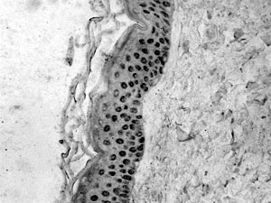 Fig. 9P63 expression in normal skin from upper eyelid basal cells. There were no great differences compared to healthy skin