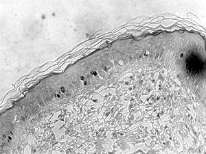 Fig. 11
