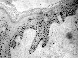 Fig. 14P63 expression is not restricted to keratinocyte stem cells but also to most of the suprabasal cells (4-5 rows)