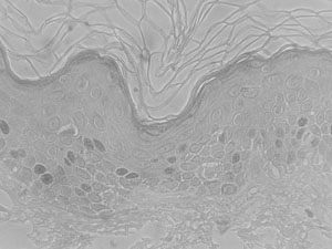 Fig. 15