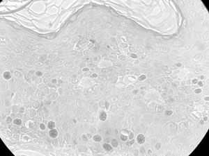 Fig. 16Suprabasal cells express more ki-67 than basal cells, suggesting that most cells expressing ki-67 also express p63. These observation suggest that p63 is expressed by keratinocytes that possess the ability to proliferate and not simply by keratinocytes that are duplicating their DNA