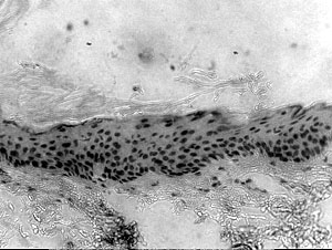 Fig. 17