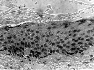 Fig. 18The proportion of cells expressing ki-67 antigen dramatically increased in the basal, parabasal, and intermediate zones