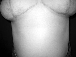 Fig. 20