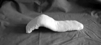 Fig. 17