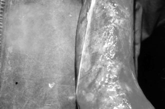 Fig. 2bCollagen applied.