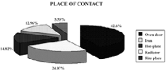 Fig. 2Causes of burns in hand palmar surface.