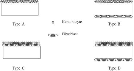 Fig. 1Types of composite skin.