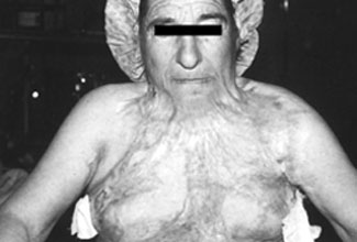 Fig. 2Two patients.