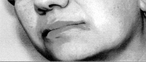 Fig. 2A closer view.
