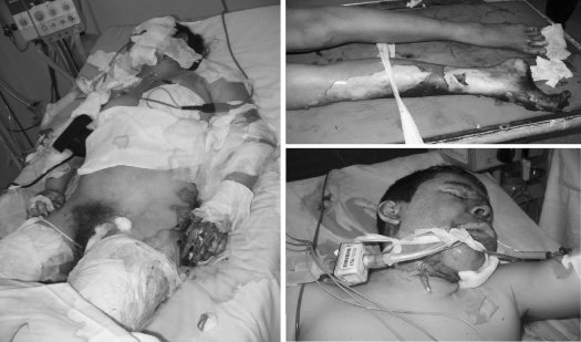 Fig. 6Other patients.