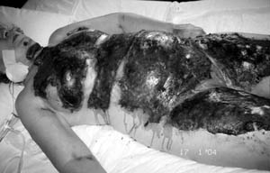 Fig. 1The patient.