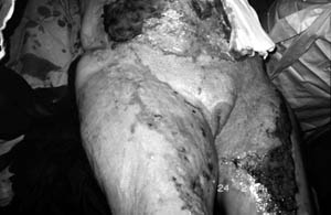 Fig. 2The patient.
