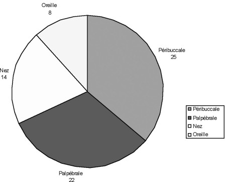 Fig. 2R�partition topographique des s�quelles de br�lures p�riorificielles de la face.