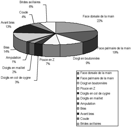 Fig. 3R�partition topographique et types de l�sions du membre sup�rieur