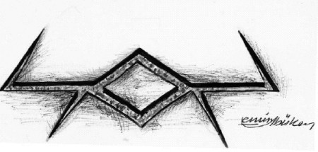 Fig. 2Rhomboid release and Z-plasties