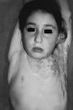 Fig. 8cPost-operative view of patient after one month