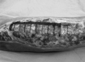 Fig. 1Deep second-degree burn wound marked in ten equal squares.