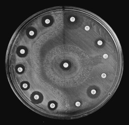 Fig. 3Sensitivity of Pseudomonas aeruginosa to antibiotics, bee honey, and antibiotics mixed with honey: comparative study.
