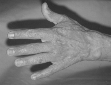 P1cAspect post-op�ratoire.