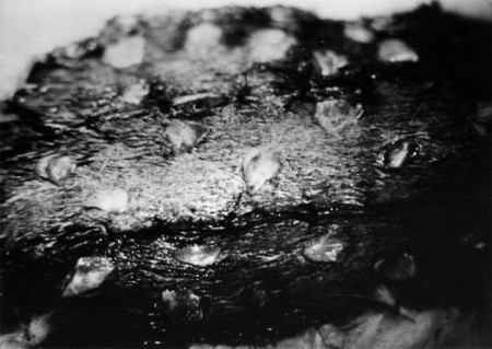 Fig. 2 A well-taken transplant with a dry wound bed.