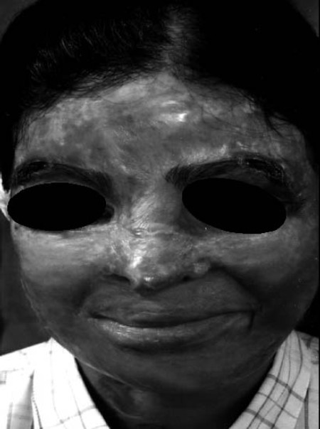 Fig. 13Early Pre-op.
