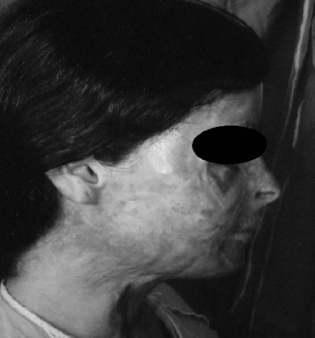 Fig. 13Anterior view. Pre-op.
