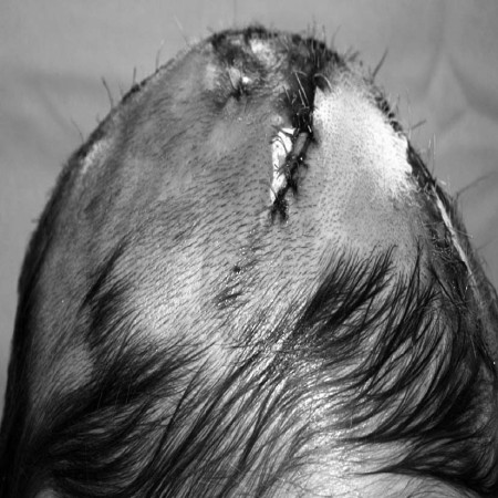 Fig. 2d Well-fed flap.