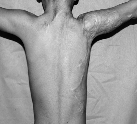 Fig. 4c Two years post-graft.