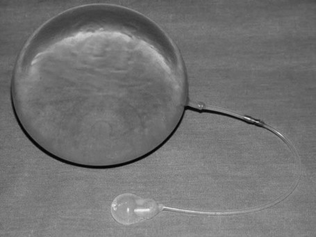 Fig. 1Plastis-M silicone expander.