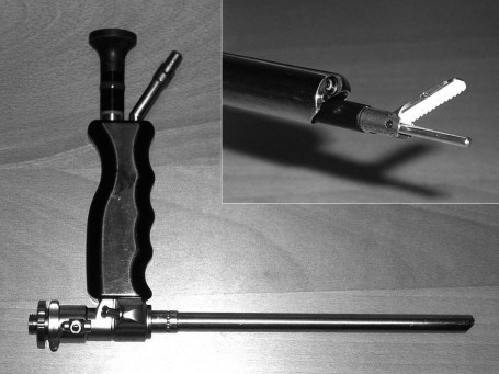 Fig. 3Endoscopic videosystem (R. Wolf, Germany) permitting simultaneous visualization, gas infusion, tissue dissection, and coagulation.