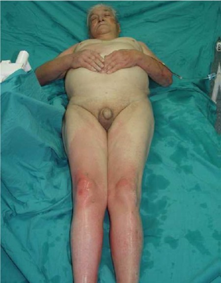 Fig. 1The patient on admission, front view.