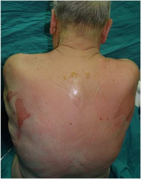 Fig. 3Back view.